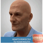 AQA™ – Advanced Custom-Fit Functional Dentures🦷(ADA recommended)(🎁Flash Sale - Don’t Miss Out)