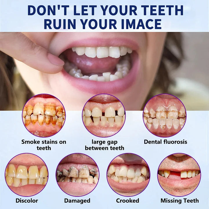 AQA™-New Generation Flexible Full Denture Solution(ADA recommended)(🎁Flash Sale - Don’t Miss Out)