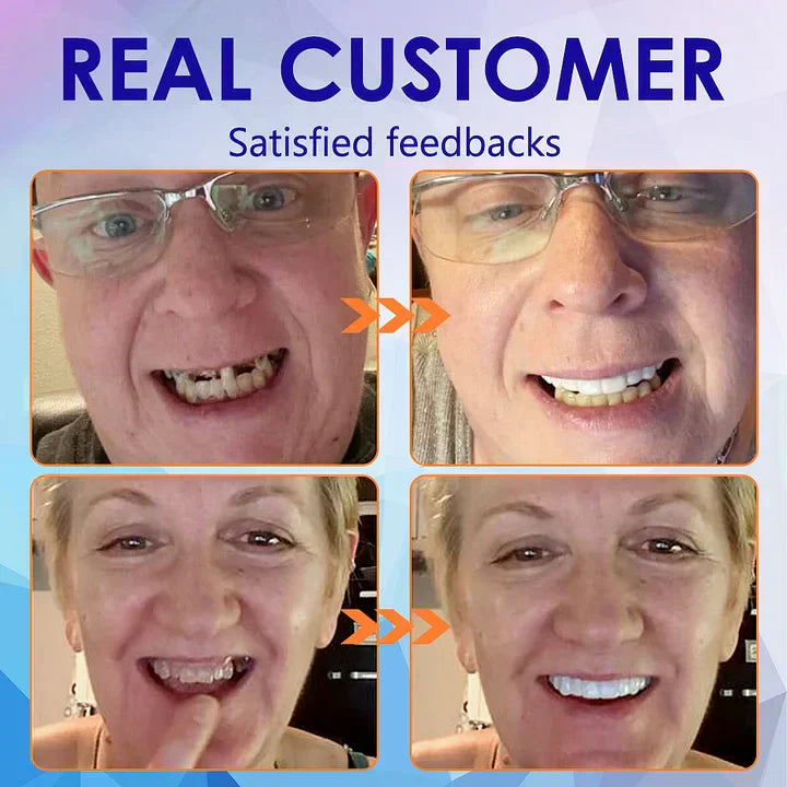 AQA™-New Generation Flexible Full Denture Solution(ADA recommended)(🎁Flash Sale - Don’t Miss Out)