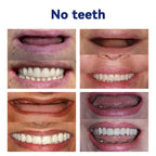 AQA™-New Generation Flexible Full Denture Solution(ADA recommended)(🎁Flash Sale - Don’t Miss Out)