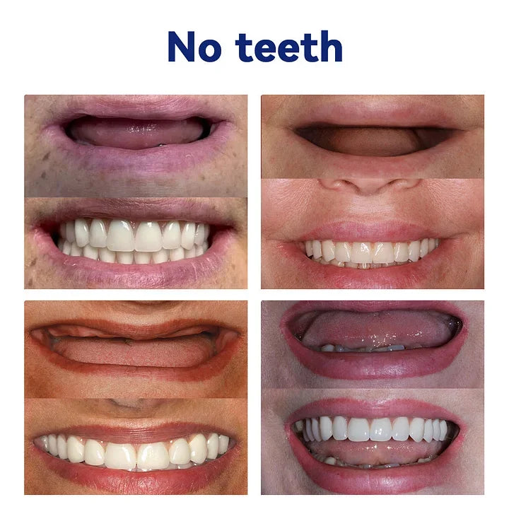 AQA™-New Generation Flexible Full Denture Solution(ADA recommended)(🎁Flash Sale - Don’t Miss Out)